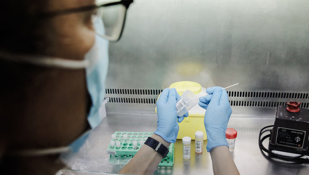 Una técnico de laboratorio sostiene una de las pruebas de análisis para la viruela del mono, en el Hospital Ramón y Cajal, a 30 de mayo de 2022, en Madrid (España)