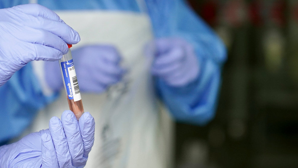 Un sanitario protegido con guantes sostiene un muestra para realizar un Análisis PCR