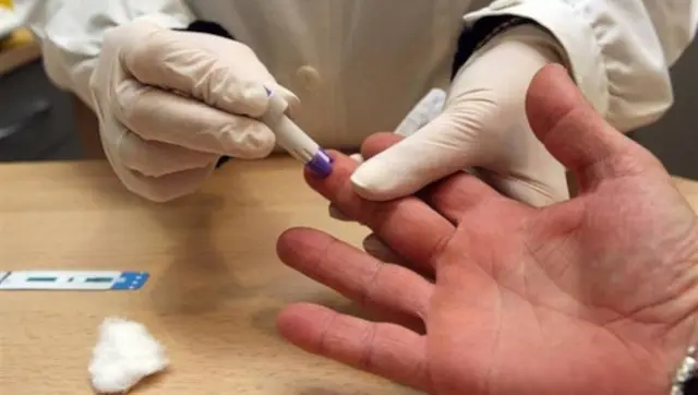 Prueba r&aacute;pida VIH