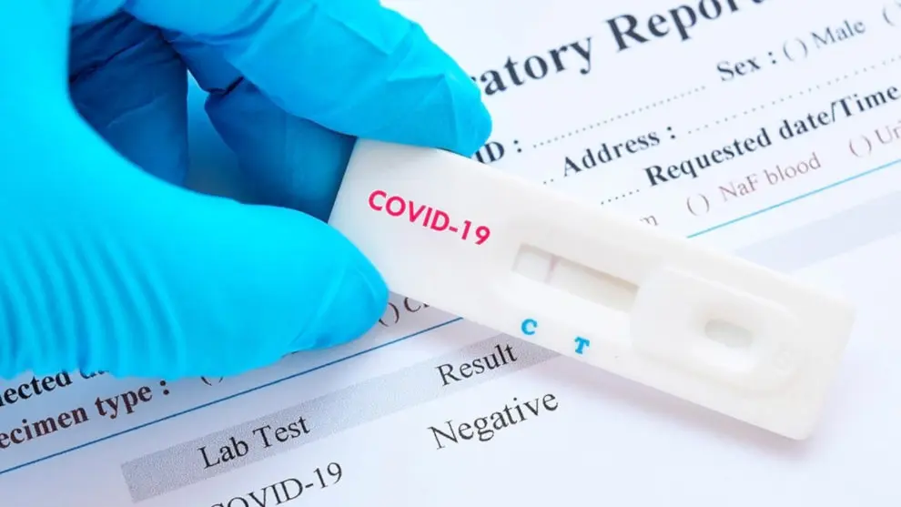 Test de detecci&oacute;n r&aacute;pida de la COVID-19