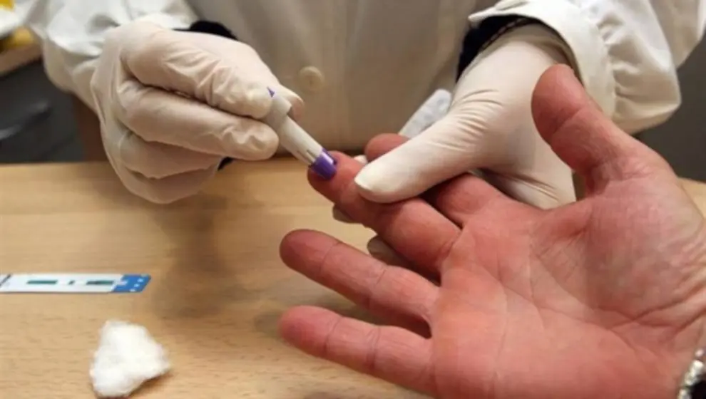 Prueba r&aacute;pida de VIH