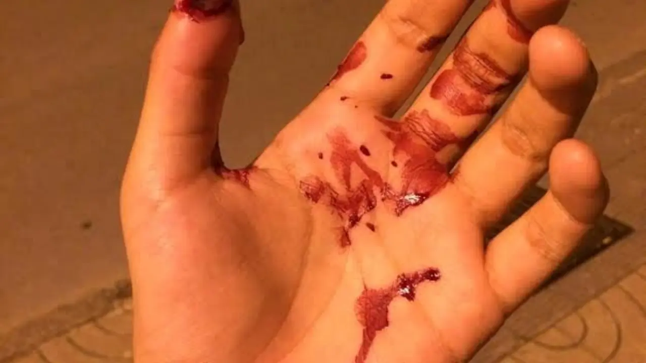 Agresi&oacute;n hom&oacute;foba en Torrelavega